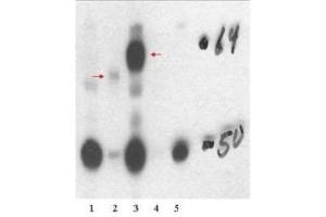 Western Blotting (WB) image for anti-Thyroid Hormone Receptor, beta (THRB) (Isoform 1), (N-Term) antibody (ABIN964895)