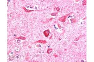 ABIN185211 (5µg/ml) staining of paraffin embedded Human Cerebral Cortex. (NIR1 抗体  (C-Term))
