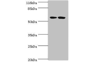 Western blot All lanes: DCAF4 antibody at 2 μg/mL Lane 1: 293T whole cell lysate Lane 2: Hela whole cell lysate Secondary Goat polyclonal to rabbit IgG at 1/10000 dilution Predicted band size: 56, 49, 45, 55 kDa Observed band size: 56 kDa (DCAF4 抗体  (AA 1-495))