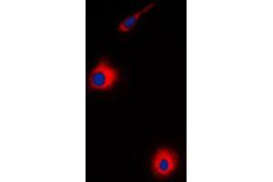 Immunofluorescent analysis of USP30 staining in HeLa cells. (Usp30 抗体  (N-Term))