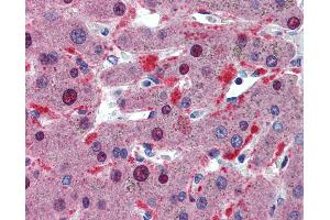 Anti-CELF1 / CUGBP1 antibody IHC of human liver.