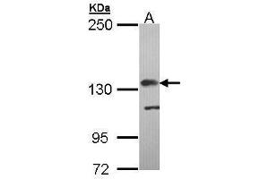 WB Image Sample (30 ug of whole cell lysate) A: Molt-4 , 5% SDS PAGE antibody diluted at 1:5000 (Complement Factor H 抗体)