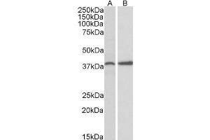ABIN571043 (0. (PRKCDBP 抗体  (Internal Region))