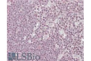 ABIN185050 (3. (PPP1R8 抗体  (C-Term))