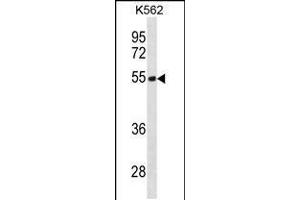 Western blot analysis in K562 cell line lysates (35ug/lane). (TES 抗体  (N-Term))