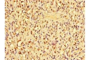 Immunohistochemistry (IHC) image for anti-Acidic (Leucine-Rich) Nuclear Phosphoprotein 32 Family, Member D (ANP32D) (AA 1-131) antibody (ABIN7143012)