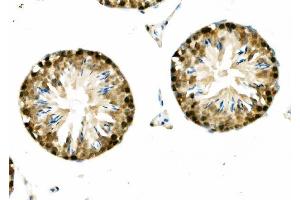 IHC analysis of DNAJA2 using anti-DNAJA2 antibody (ABIN7598991).