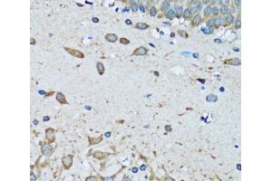 Immunohistochemistry of paraffin-embedded Mouse brain using FDFT1 Polyclonal Antibody at dilution of 1:100 (40x lens). (FDFT1 抗体)