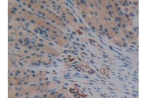 Immunohistochemistry (IHC) image for anti-Synuclein, gamma (Breast Cancer-Specific Protein 1) (SNCG) (AA 1-123) antibody (ABIN7429346)