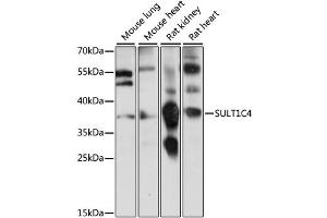 Western blot analysis of extracts of various cell lines, using SULT1C4 antibody (ABIN6293706) at 1:1000 dilution. (SULT1C4 抗体)