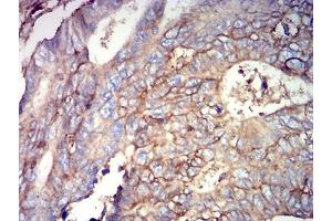 Immunohistochemistry (IHC) image for anti-CD44 (CD44) (AA 36-194) antibody (ABIN5684103)