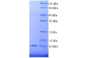 SDS-PAGE (SDS) image for Carcinoembryonic Antigen-Related Cell Adhesion Molecule 4 (CEACAM4) (AA 36-155), (partial) protein (His tag) (ABIN5713346) (CEACAM4 Protein (AA 36-155, partial) (His tag))