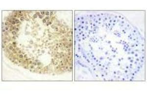 Immunohistochemistry analysis of paraffin-embedded human testis tissue, using ECRG4 antibody. (MEMO1 抗体)