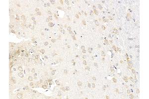 ABIN7094804 and ABIN7098855 at 1/100 staining Rat brain tissue by IHC-P.