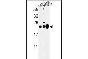 Western blot analysis of CBX1 Antibody (C-term) (ABIN652861 and ABIN2842560) in MCF-7, , Y79 cell line lysates (35 μg/lane). (CBX1 抗体  (C-Term))
