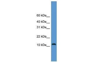 Western Blot showing CDC26 antibody used at a concentration of 1-2 ug/ml to detect its target protein.