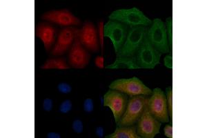 ABIN6257097 and ABIN6275838 staining Hela cells by IF/ICC. (Casein Kinase 1 delta 抗体  (Internal Region))