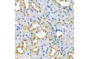 Immunohistochemistry (Paraffin-embedded Sections) (IHC (p)) image for anti-NADH Dehydrogenase (Ubiquinone) 1 beta Subcomplex, 10, 22kDa (NDUFB10) (AA 1-172) antibody (ABIN6144472)