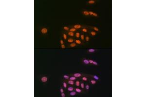 Immunofluorescence analysis of U-2 OS cells using K/MYST1/MOF Rabbit mAb (ABIN7268063) at dilution of 1:100 (40x lens). (MYST1 抗体)