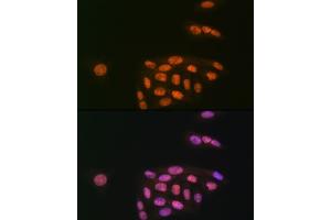 Immunofluorescence analysis of U-2 OS cells using K/MYST1/MOF Rabbit mAb (ABIN7268063) at dilution of 1:100 (40x lens). (MYST1 抗体)