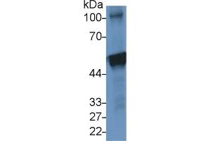 Detection of CK10 in Human A431 cell lysate using Polyclonal Antibody to Cytokeratin 10 (CK10) (Keratin 10 抗体  (AA 153-456))