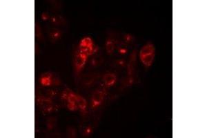 Immunofluorescent analysis of HAI-1 staining in Hela cells. (SPINT1 抗体)
