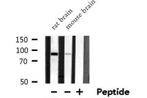 Western blot analysis of ARNT  expression in various lysates (ARNT 抗体  (N-Term))
