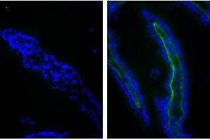 Immunofluorescence (IF) image for anti-Collagen, Type I (COL1) antibody (FITC) (ABIN5707019)