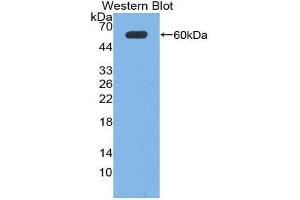 Western Blotting (WB) image for anti-Neuronal Pentraxin 1 (NPX1) (AA 115-364) antibody (ABIN1869514) (NPX1 抗体  (AA 115-364))