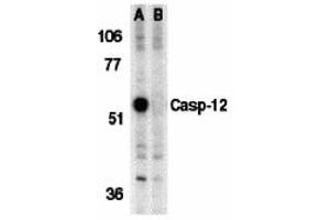 Western Blotting (WB) image for anti-Caspase 12 (Gene/pseudogene) (CASP12) (Middle Region) antibody (ABIN1030898) (Caspase 12 抗体  (Middle Region))