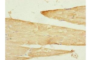 Immunohistochemistry of paraffin-embedded human skeletal muscle tissue using ABIN7170343 at dilution of 1:100 (SAMM5 (AA 1-220) 抗体)