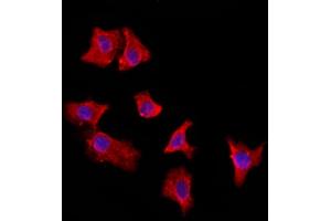 ABIN6264959 and ABIN6272887 staining HepG2 by IF/ICC.
