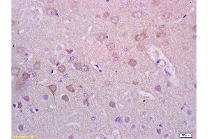 Formalin-fixed and paraffin embedded rat brain tissue with labeled Anti-Alpha-Synuclein/Syn/SNCA Polyclonal Antibody, Unconjugated  at 1:200, followed by conjugation to the secondary antibody and DAB staining (SNCA 抗体  (AA 1-140))