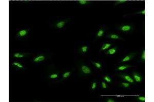Immunofluorescence of monoclonal antibody to EHMT1 on HeLa cell. (EHMT1 抗体  (AA 1-100))