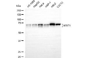 Western blotting analysis using KRIT1 antibody (ABIN7799213).