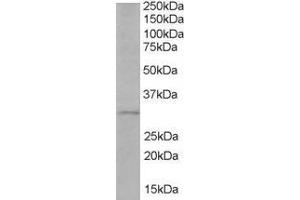 Western Blotting (WB) image for anti-Toll-Interleukin 1 Receptor (TIR) Domain Containing Adaptor Protein (TIRAP) (C-Term) antibody (ABIN184633)