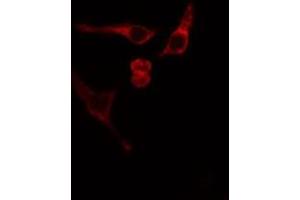 ABIN6275839 staining Hela cells by IF/ICC. (MATK 抗体  (Internal Region))