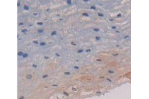 IHC-P analysis of Human Tissue, with DAB staining. (Cytokeratin 13 抗体  (AA 104-403))