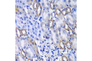 Immunohistochemistry of paraffin-embedded mouse kidney using MATK antibody  at dilution of 1:100 (40x lens). (MATK 抗体  (AA 352-466))