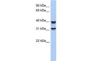 WB Suggested Anti-C5orf35 Antibody Titration: 0. (C5orf35 抗体  (N-Term))