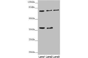 Western blot All lanes: GAS2L1 antibody at 0. (GAS2L1 抗体  (AA 130-400))