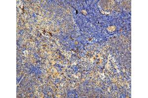 IHC analysis of IL31 using anti-IL31 antibody (ABIN6719334).