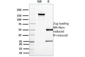 SDS-PAGE Analysis Purified CDC34 Mouse Monoclonal Antibody (CPTC-CDC34-2). (CDC34 抗体)
