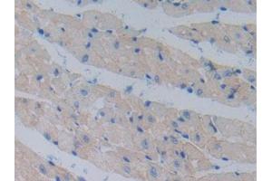 DAB staining on IHC-P; Samples: Mouse Heart Tissue (Cadherin 13 抗体  (AA 478-690))
