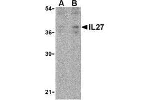 Western blot analysis of IL-27 in EL4 lysate with AP30420PU-N IL-27 antibody at (A) 2 and (B) 4 μg/ml. (IL27 抗体  (N-Term))