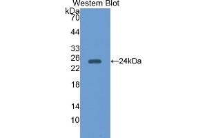 Western blot analysis of the recombinant protein. (Peroxiredoxin 5 抗体  (AA 1-213))
