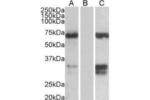 HEK293 lysate (10 µg protein in RIPA buffer) over expressing Human FOXC2 with DYKDDDDK tag probed with ABIN185029 (0. (FOXC2 抗体  (C-Term))