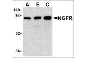 Western blot analysis of (A) 25 ng, (B) 50 ng, and (C) 100 ng of purified recombinant NGFR with this product at 1 μg/ml. (NGFR 抗体)