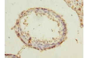 Immunohistochemistry of paraffin-embedded human testis tissue using ABIN7168477 at dilution of 1:100 (RUNDC3A 抗体  (AA 1-405))