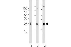 Western Blotting (WB) image for anti-RAC1 antibody (ABIN3032428)